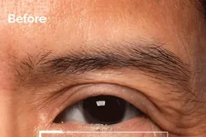 Instantly firm your eye area.